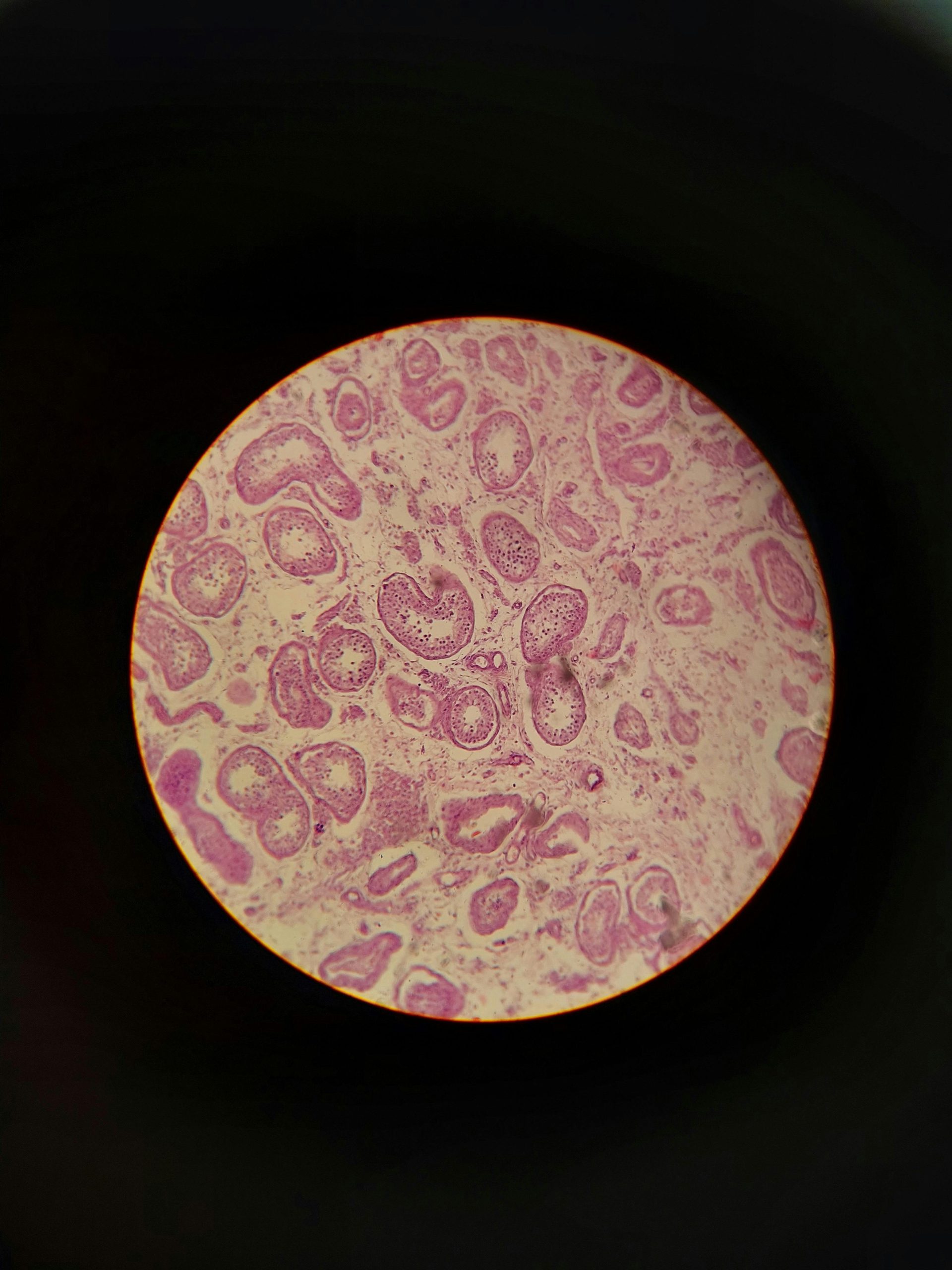 Stimulation du collagène avec inducteur tissulaire