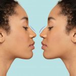 Rhinoplastie médicale