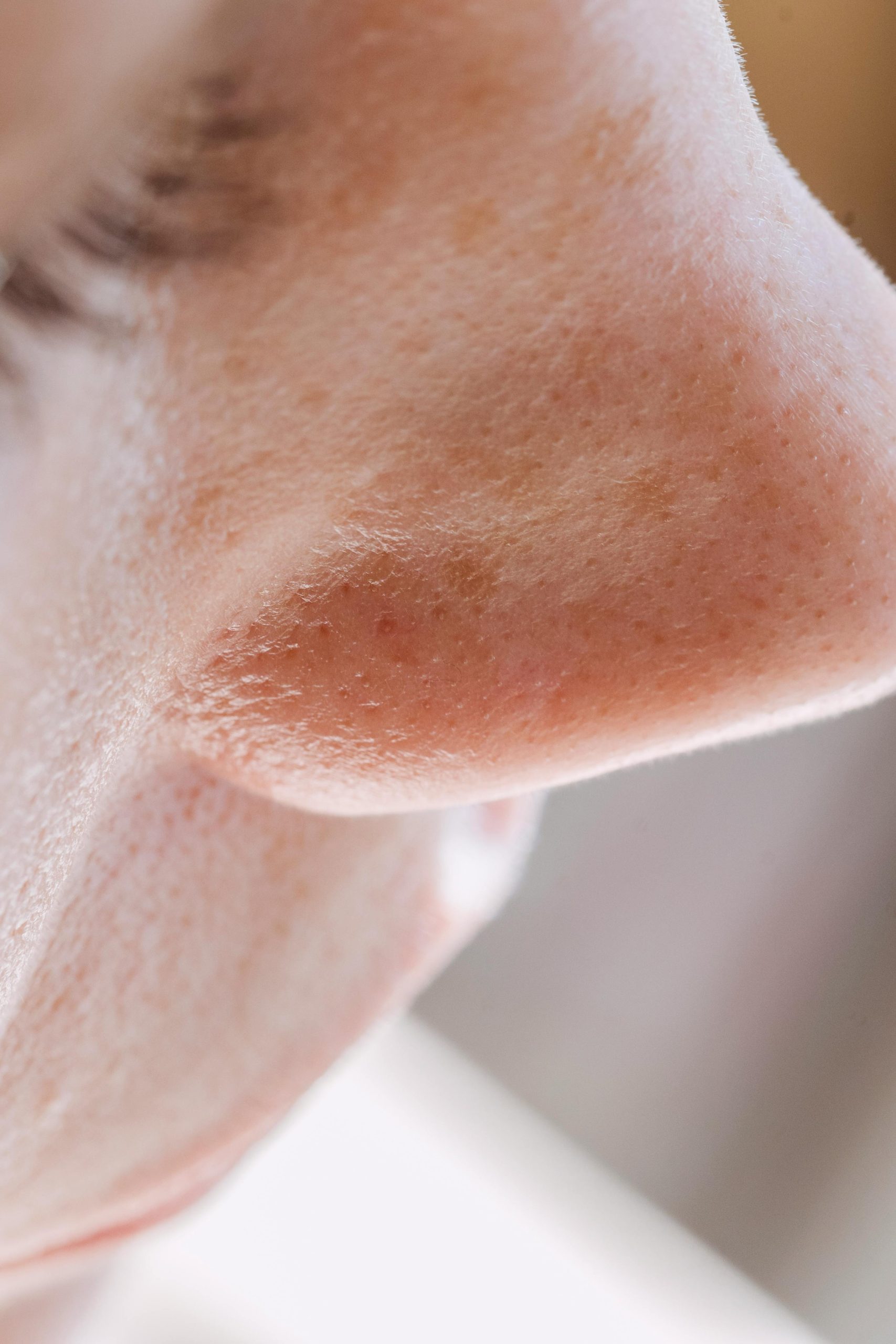 Méthodes rapides pour réduire la taille du nez