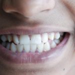 Close-up image of a person's smile highlighting teeth and lips, vibrant and cheerful. Gros plan du sourire d'une personne mettant en évidence les dents et les lèvres, vibrant et joyeux.