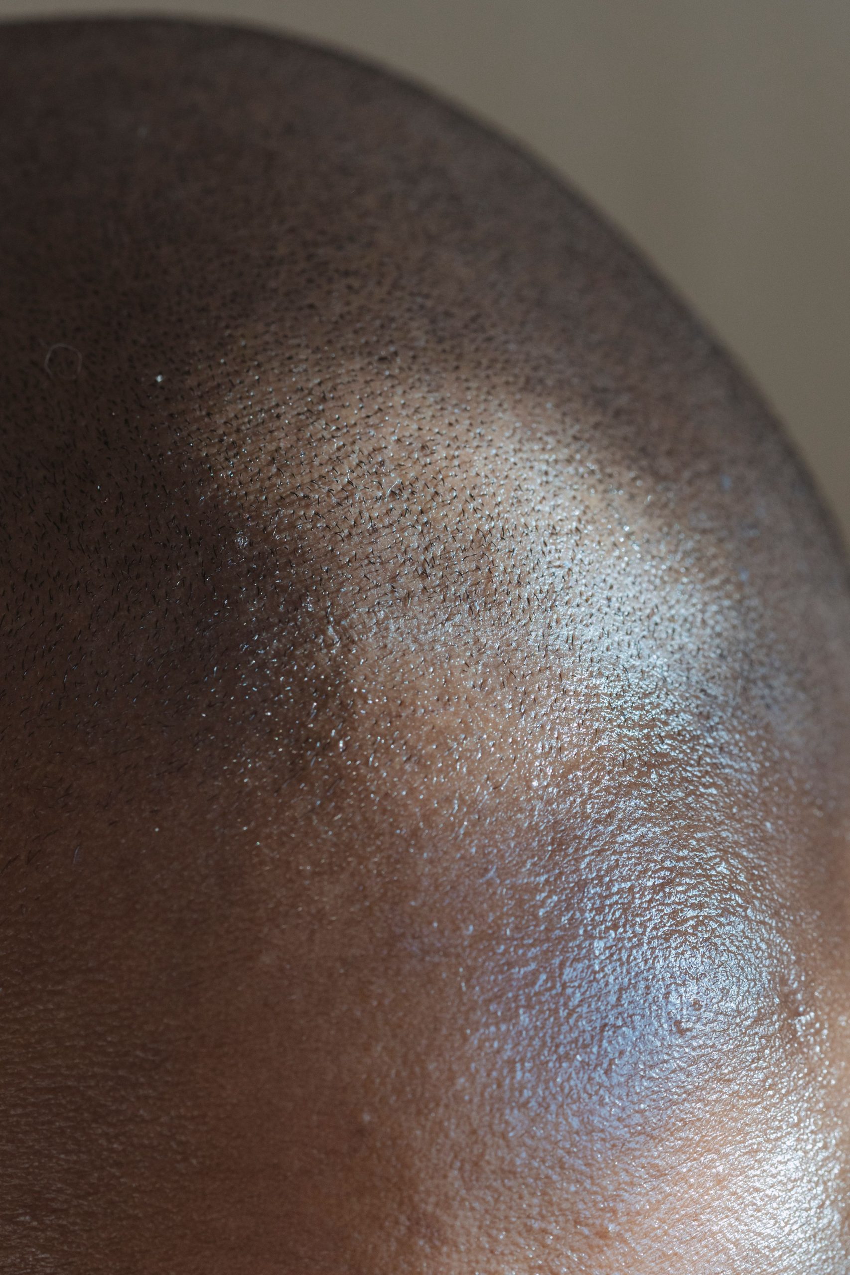 Explication détaillée d'un bouton derrière la tête
