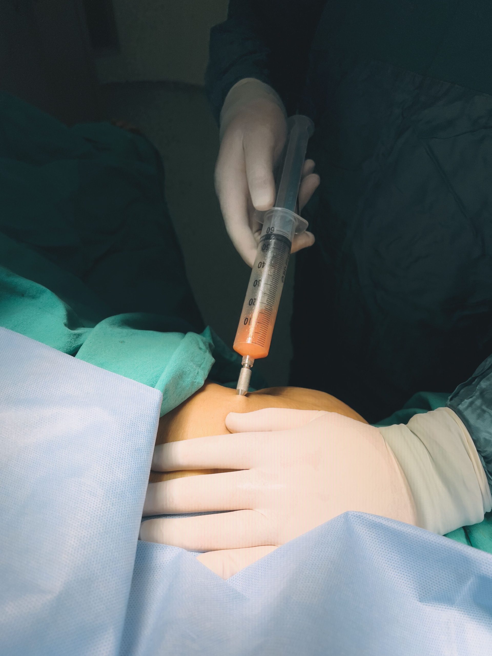 Doctor performs injection procedure, highlighting healthcare precision. Un médecin effectue une procédure d'injection, mettant en évidence la précision des soins de santé.