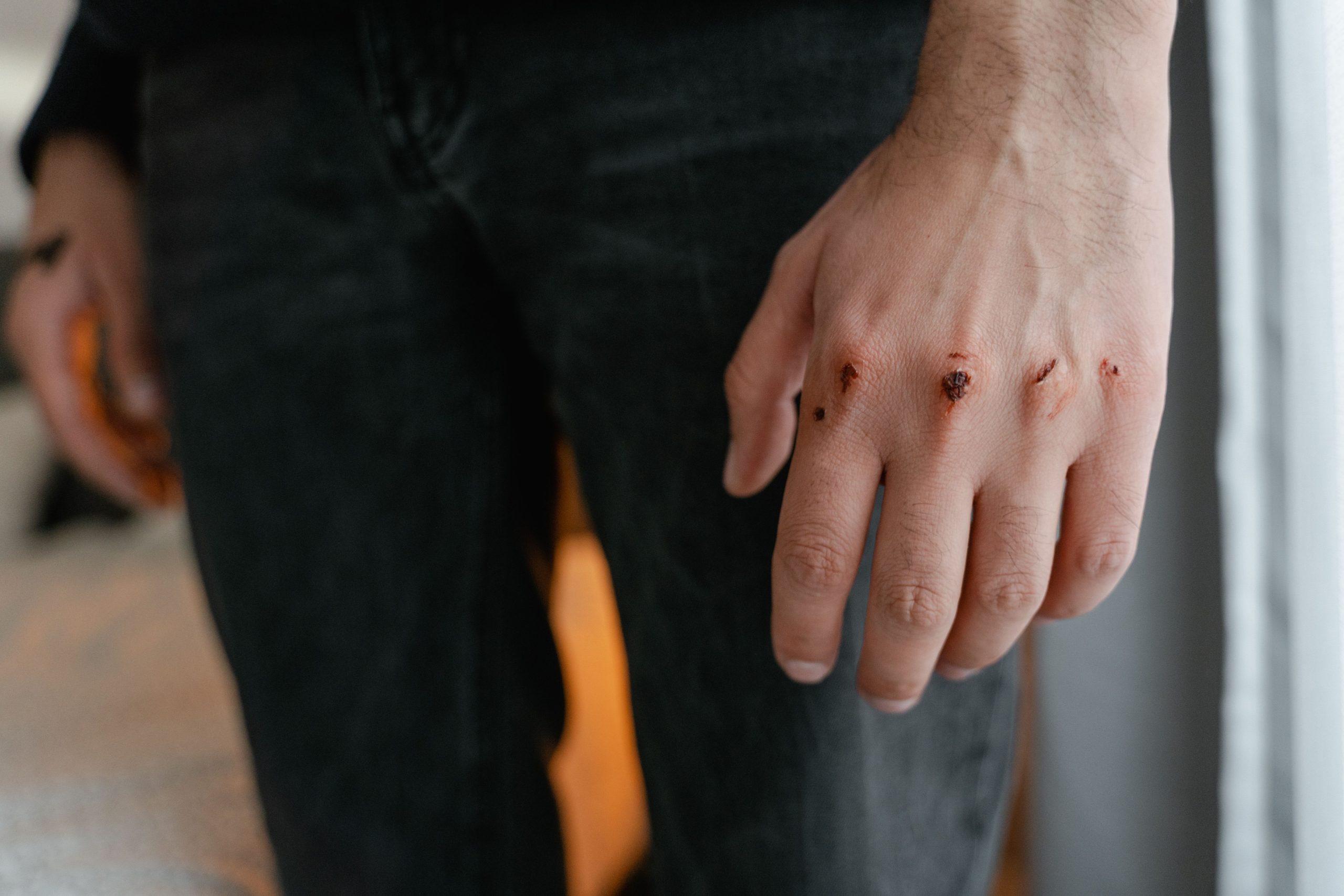 Pourquoi un doigt est douloureux et gonflé