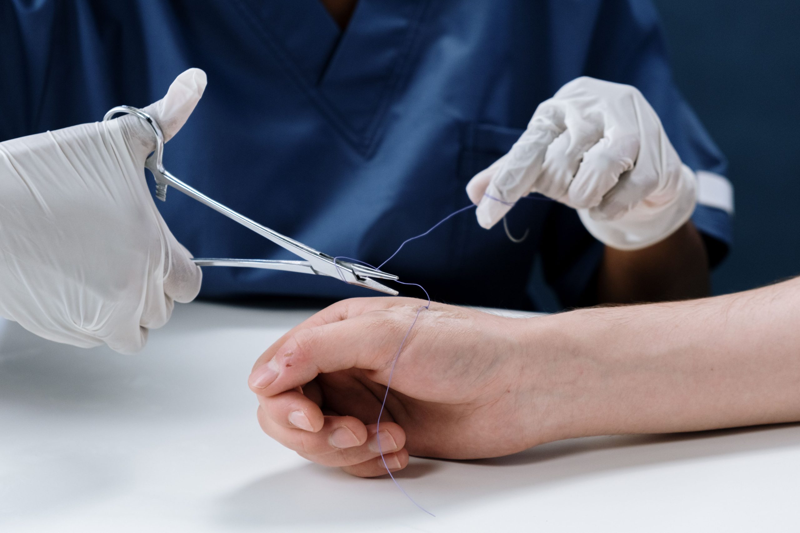 Durée de vie des différents fils de suture résorbables