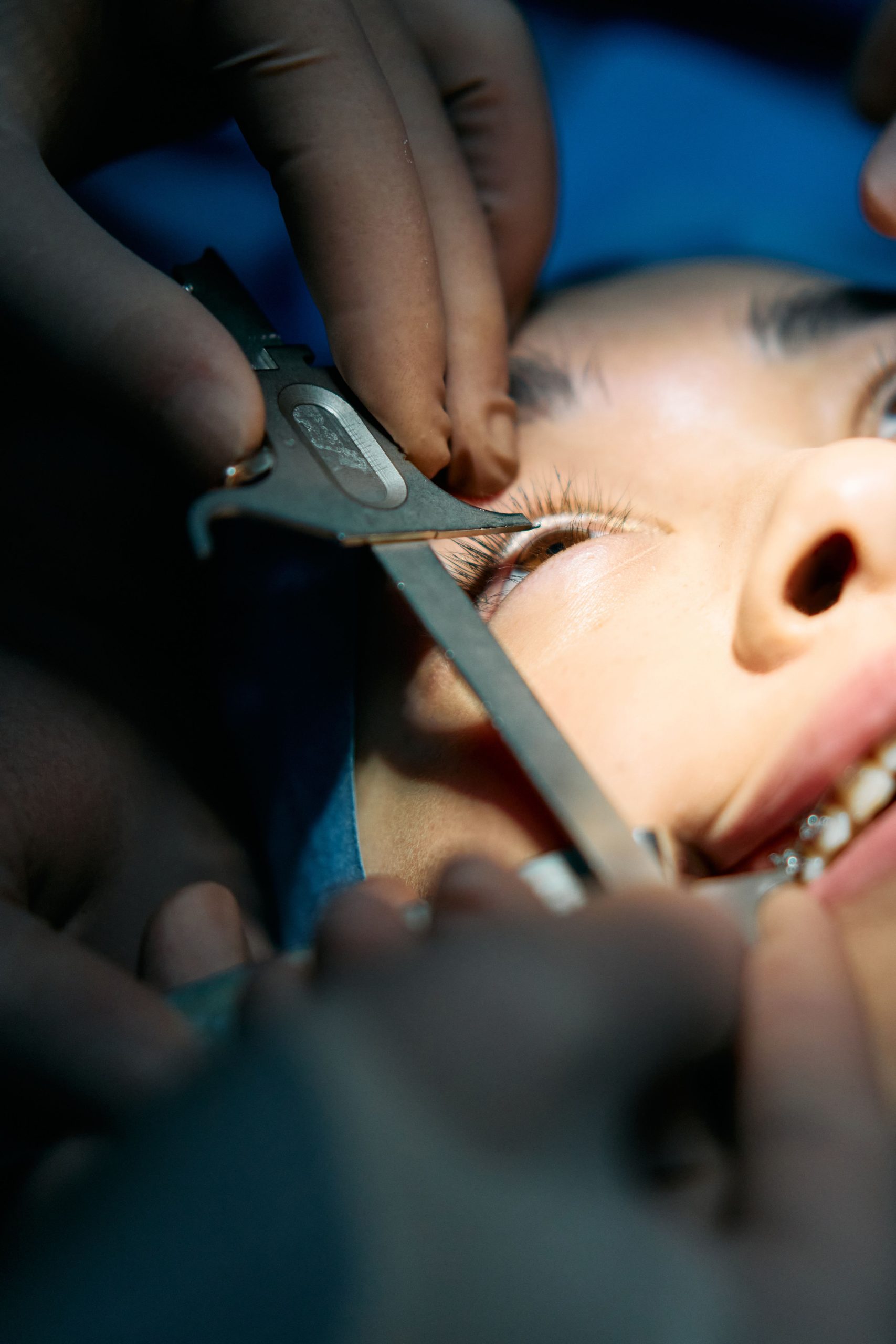 Frein de lèvre court chirurgie nécessaire
