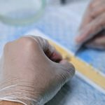 Detailed view of hair graft preparation during a hair transplant surgery. Vue détaillée de la préparation de la greffe de cheveux lors d'une chirurgie de transplantation capillaire.