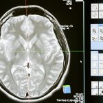 Intricate MRI brain scan displayed on a computer screen for medical analysis and diagnosis. Analyse détaillée d'une IRM cérébrale affichée sur un écran informatique pour l'analyse et le diagnostic médical.