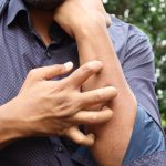 A man in a blue shirt scratching his arm outdoors, highlighting skin irritation. Un homme en chemise bleue se grattant le bras à l'extérieur, mettant en évidence une irritation de la peau.