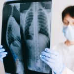 A medical professional analyzes a chest x-ray wearing gloves and a mask in a clinical setting. Un professionnel médical analyse une radiographie thoracique en portant des gants et un masque dans un environnement clinique.