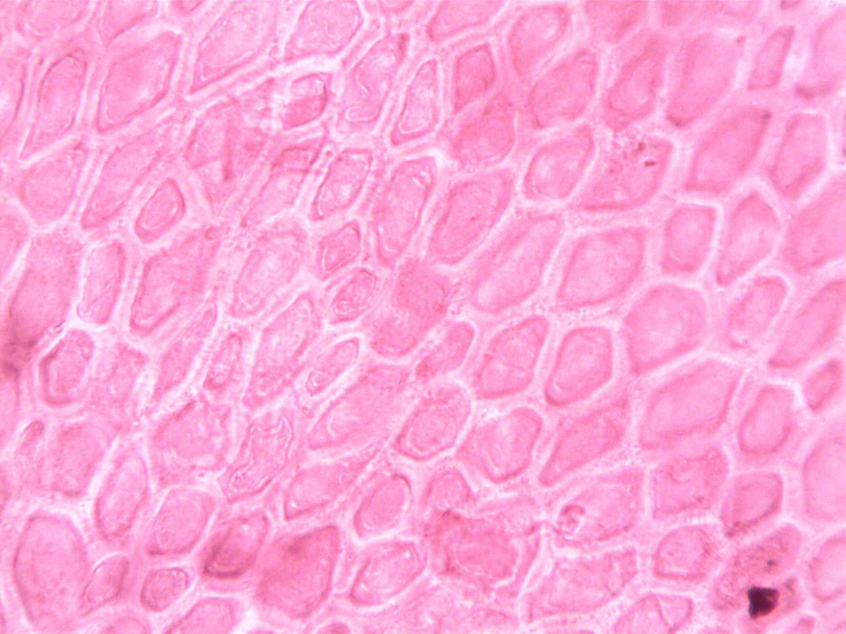 Cellules sanguines filtrées par la rate