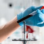 Prise de sang au laboratoire pour un bilan hépatique