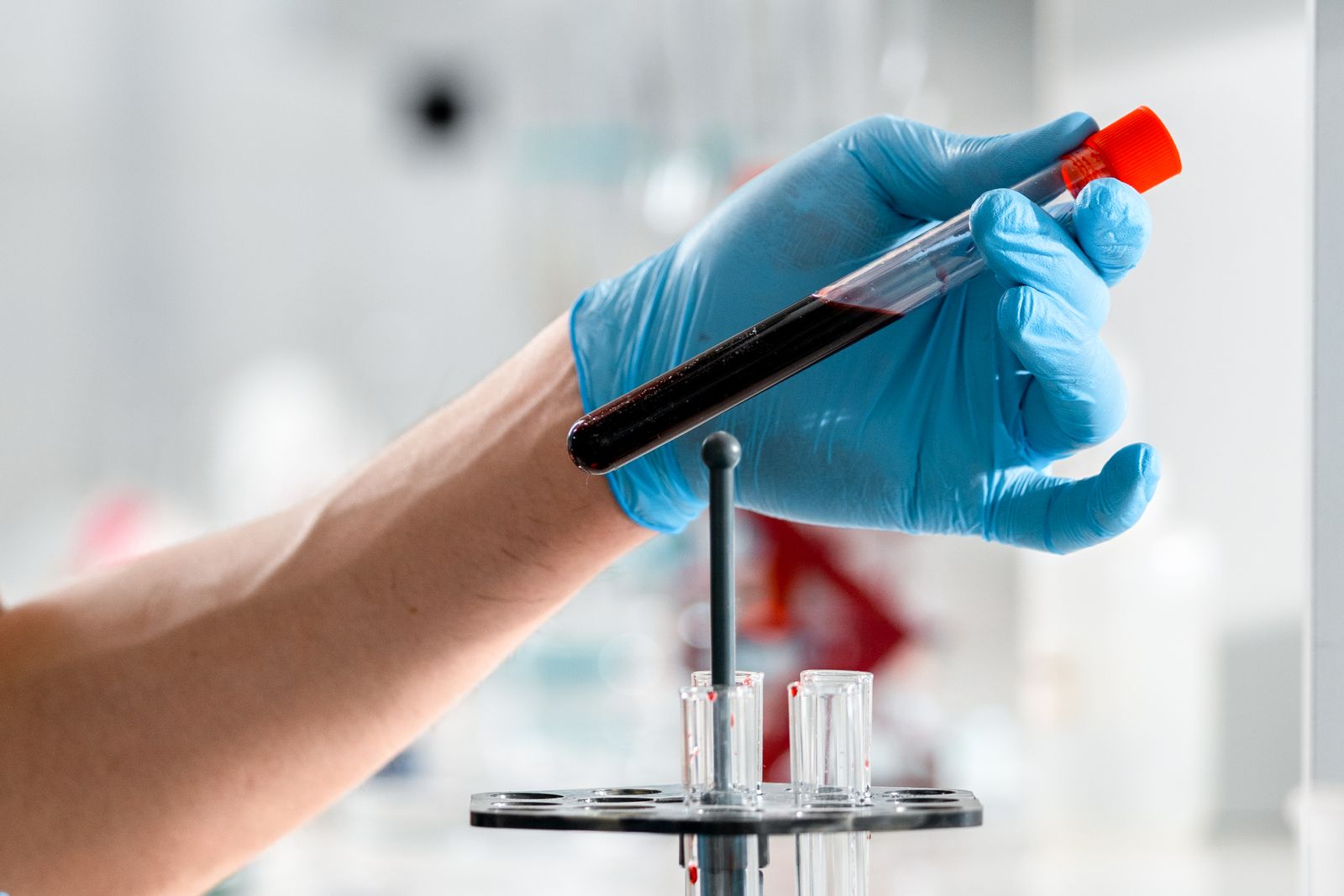 Prise de sang au laboratoire pour un bilan hépatique