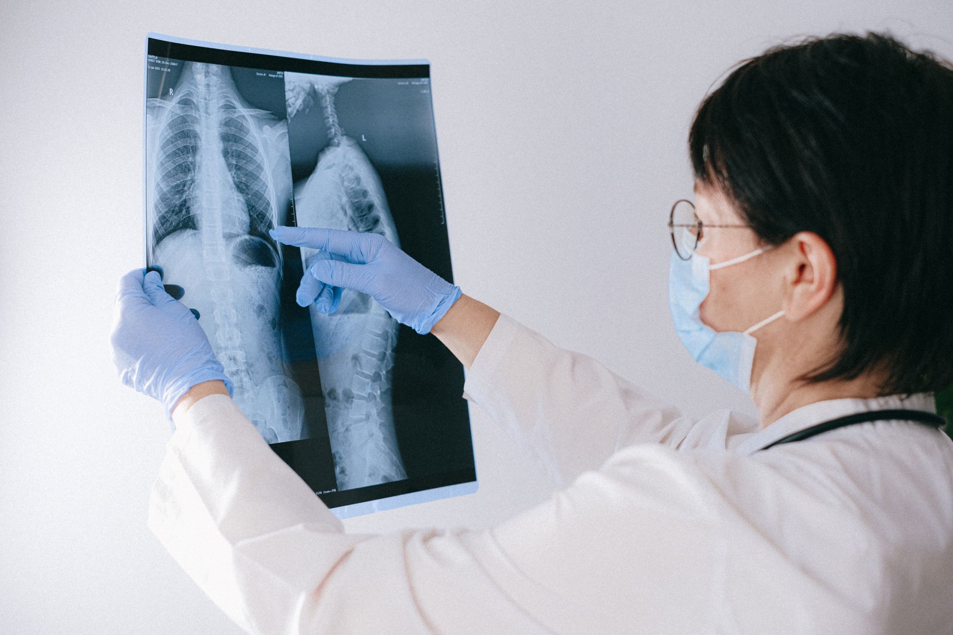 Médecin qui examine une radiographie du thorax