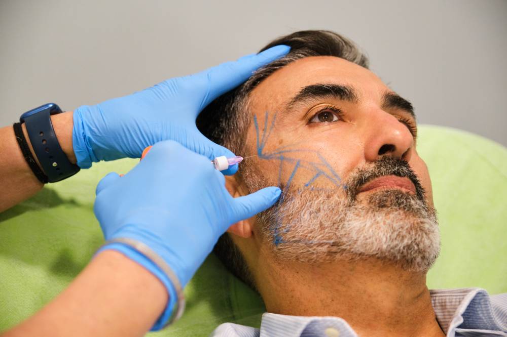 étapes consultation lifting visage Montpellier