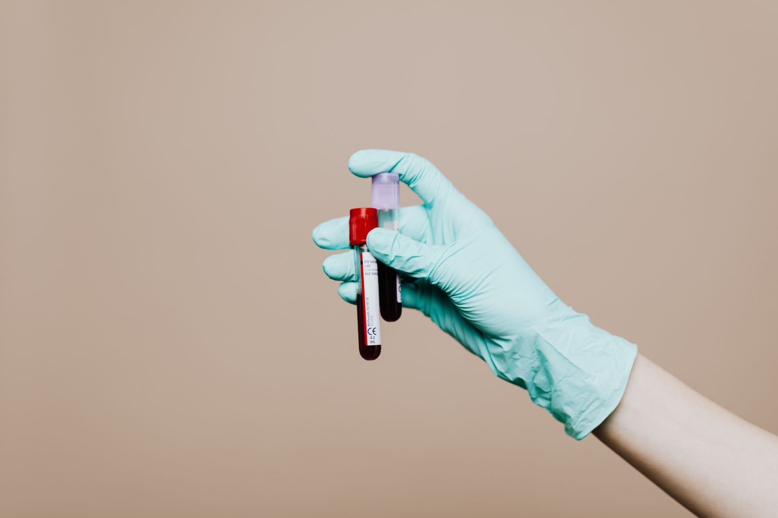 Tubes de prise de sang tenus par une main gantée